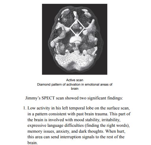 Your Brain Is Always Listening by Daniel G Amen PDF