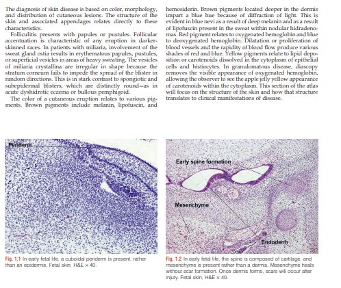 Andrews’ Diseases of the Skin Clinical Atlas by William D. James & 3 more PDF